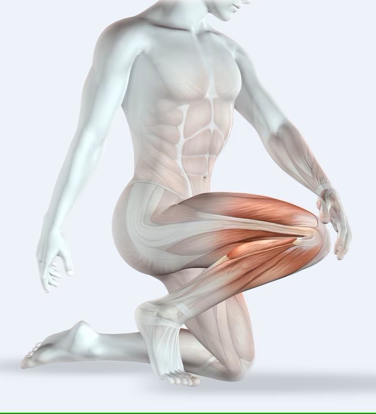 personnage masculin en 3D tenant son genou douloureux pour le syndrome des loges